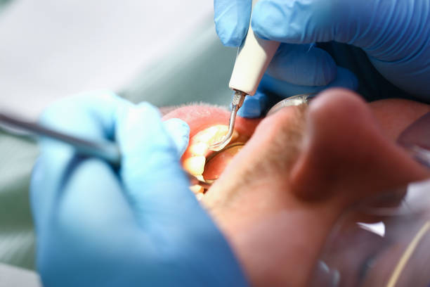 Best Emergency Dental Extractions in Ceresco, NE
